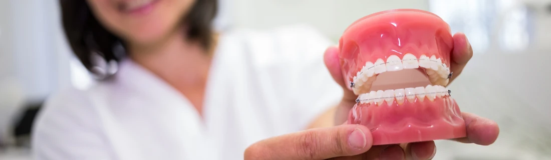 Person holding a dental model with braces on upper and lower teeth in a blurred clinical setting.