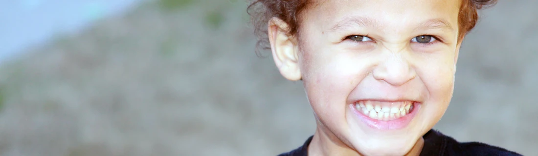 Close-up of a child showing teeth, with face partially visible against a blurred background.